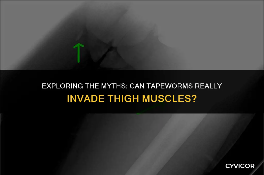 do tapeworms get into thigh muscle