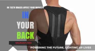 Exploring the Surprising Connection: Braces and Back Muscles