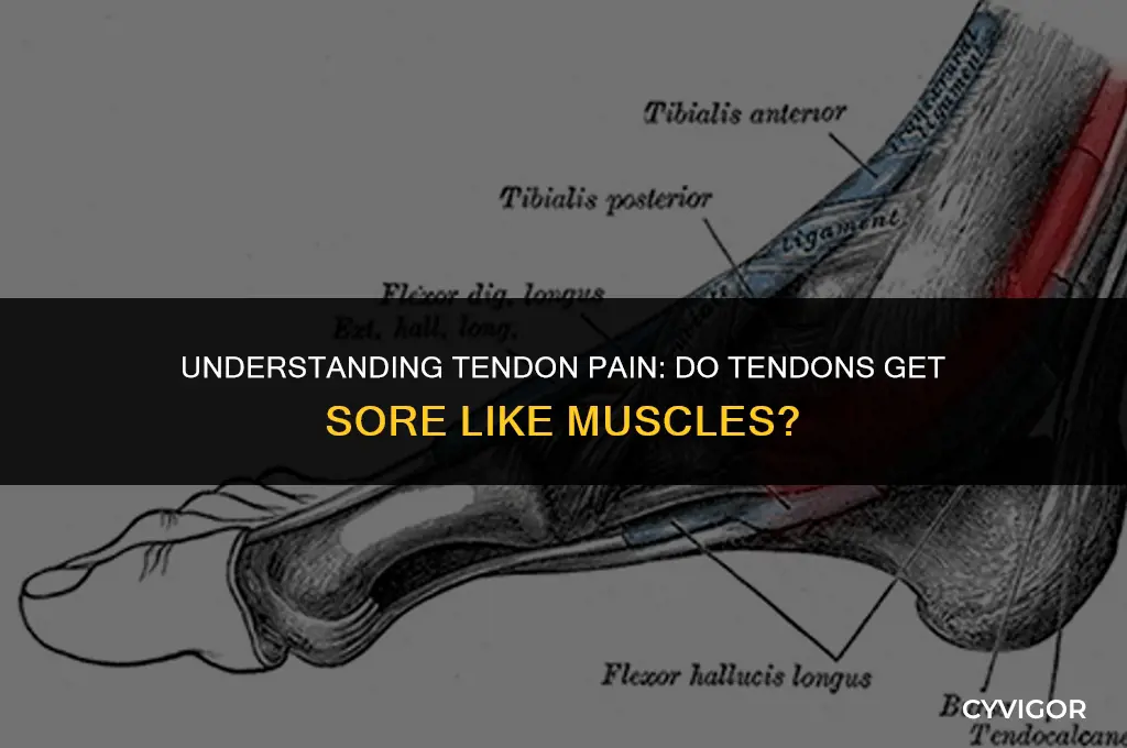 do tendons get sore like muscles