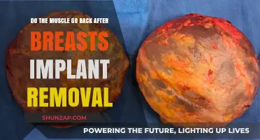 Regaining Natural Firmness: What Happens to Muscles After Breast Implant Removal