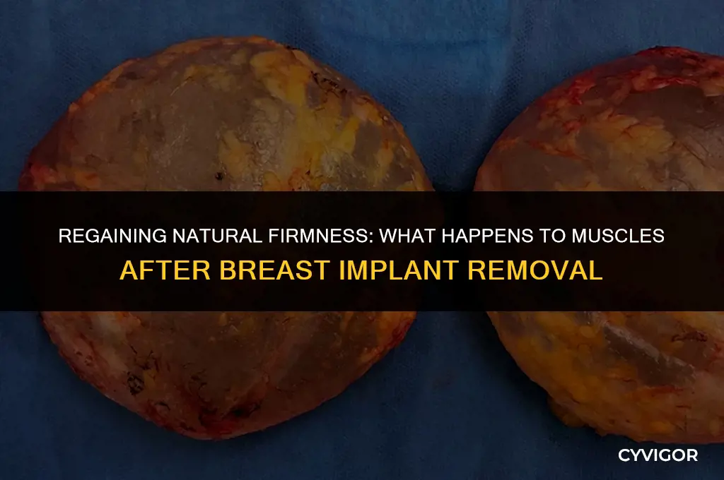 do the muscle go back after breasts implant removal