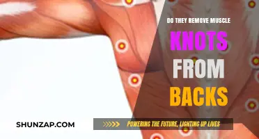 Unraveling the Myth: Can Muscle Knots Really Be Removed from Your Back?