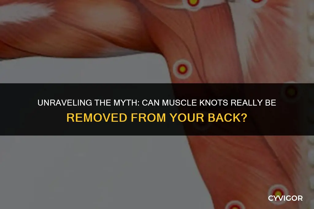 do they remove muscle knots from backs