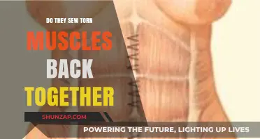 Mending Muscle Tears: The Surgical Process Explained