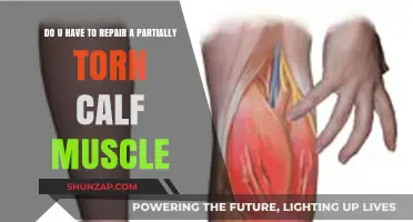 Healing a Partially Torn Calf Muscle: Repair or Rest?