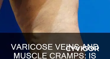 do varicose veins cause muscle cramps