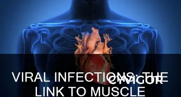 do viral infections cause muscle aches
