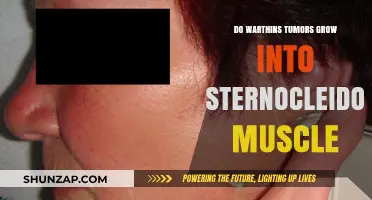 Warthin's Tumors and Sternocleidomastoid Muscle: Growth Potential Explained