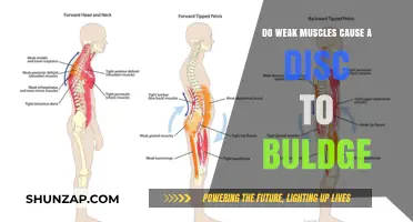 Weak Muscles: The Root Cause of Disc Bulge?