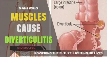 Stomach Muscles and Diverticulitis: What's the Connection?