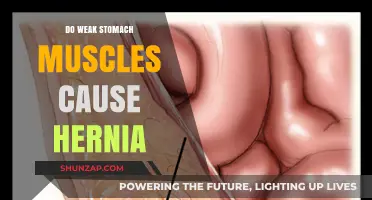 Weak Stomach Muscles: A Hernia Risk Factor?