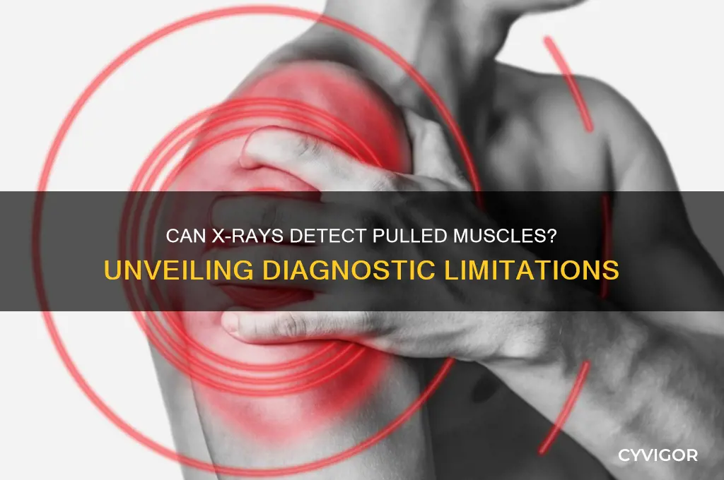 do x rays show pulled muscles
