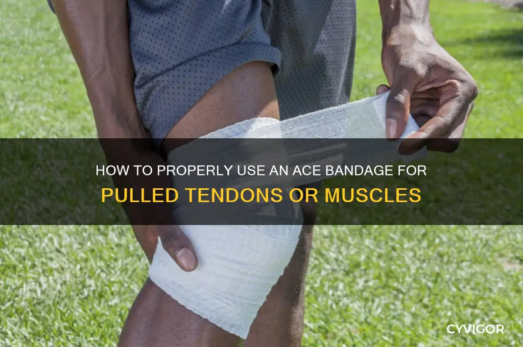do you ace bandage a pulled tendon or muscle