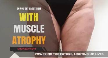 Understanding Muscle Atrophy: Does It Lead to Saggy Skin?