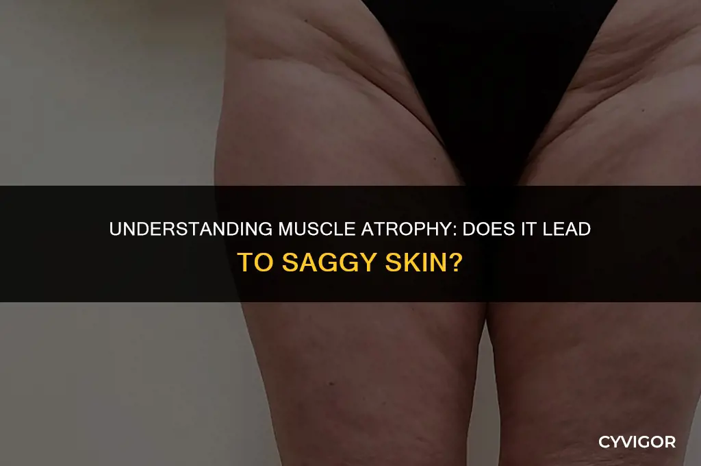 do you get saggy skin with muscle atrophy