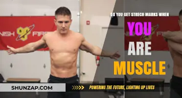 Muscle Gain and Stretch Marks: What You Need to Know