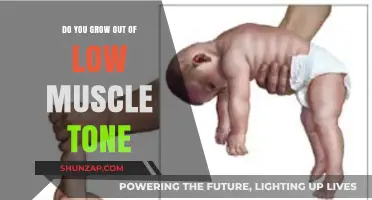 Can You Outgrow Low Muscle Tone? Understanding Its Long-Term Impact