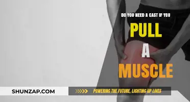 Pulled Muscle: Do You Really Need a Cast for Recovery?