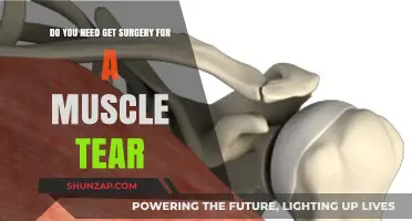 Considering Surgery for a Muscle Tear: What You Need to Know