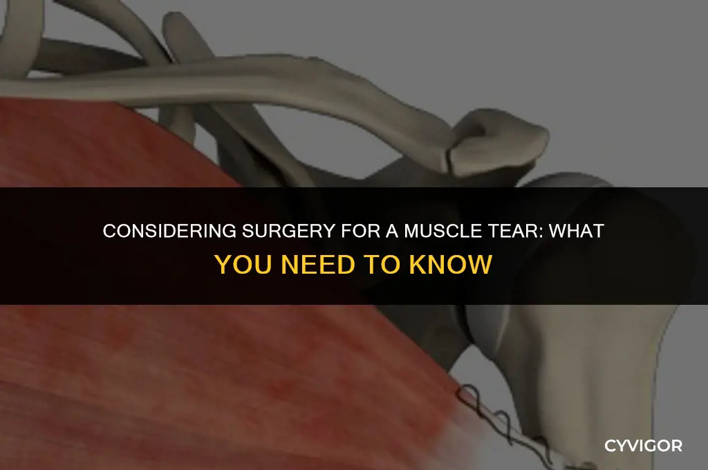 do you need get surgery for a muscle tear