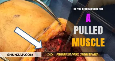 Pulled Muscle Surgery: Is It Necessary for Recovery?