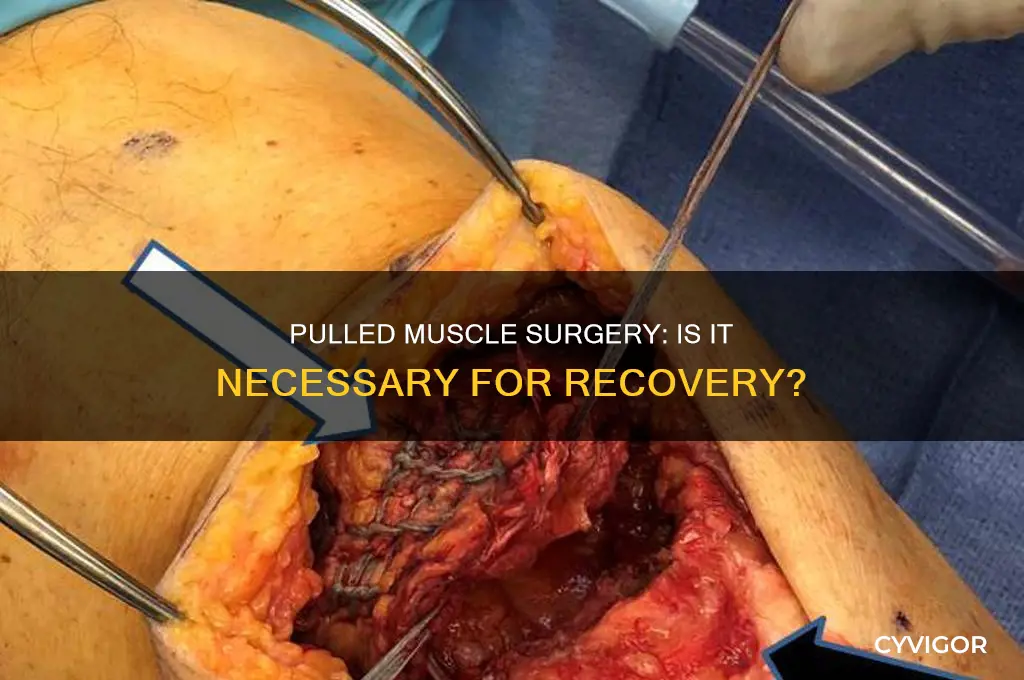 do you need surgery for a pulled muscle