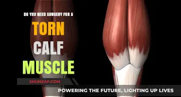 Considering Surgery for a Torn Calf Muscle: What You Need to Know