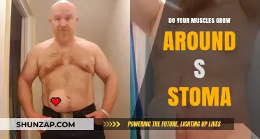 Muscle Growth Around a Stoma: Facts, Myths, and Fitness Tips