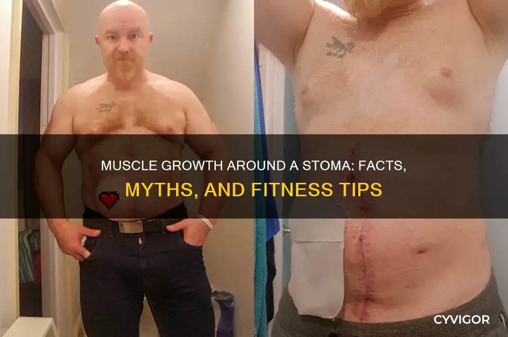 do your muscles grow around s stoma