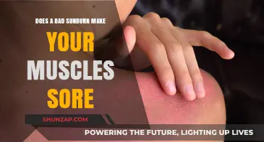 Sunburn and Muscle Soreness: Unraveling the Unexpected Connection