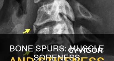 does a bone spur cause muscle soreness and stiffness