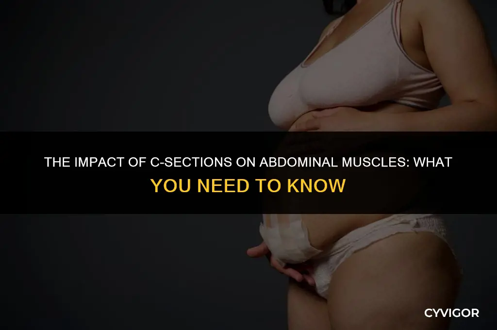 does a c section affect stomach muscles