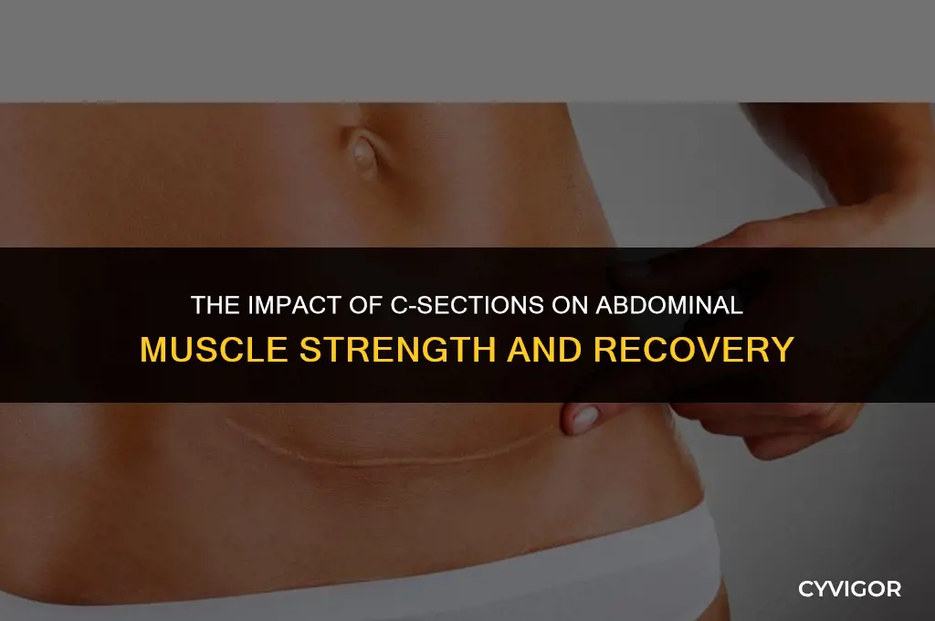 does a c section affect your ab muscles
