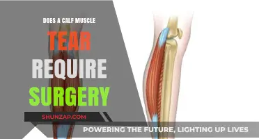 Calf Muscle Tear: Surgical Intervention or Conservative Treatment?