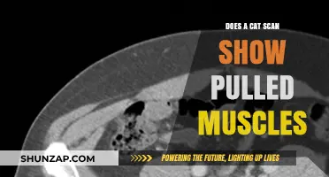 Can a CT Scan Detect Pulled Muscles? The Truth Revealed