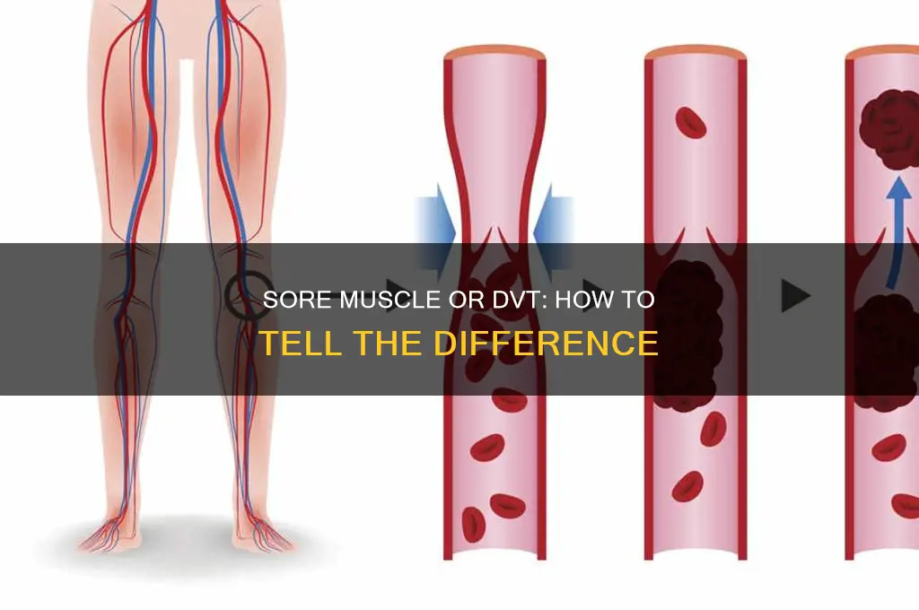 does a dvt feel like a sore muscle