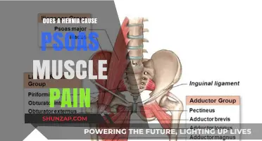 Hernias and Psoas Pain: What's the Link?
