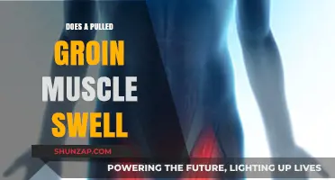 Pulled Groin Muscle: Understanding Swelling and Recovery Tips