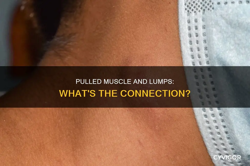 does a pulled muscle cause a lump