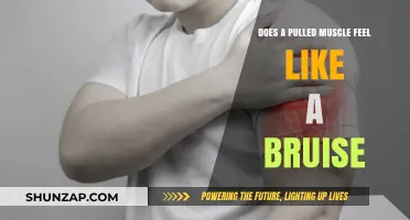 Pulled Muscle vs. Bruise: Understanding the Pain and Symptoms
