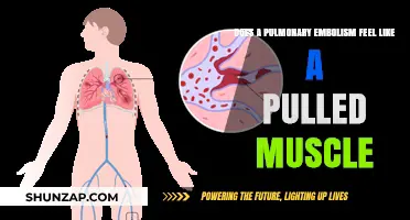 Pulmonary Embolism vs. Pulled Muscle: Recognizing the Difference in Symptoms