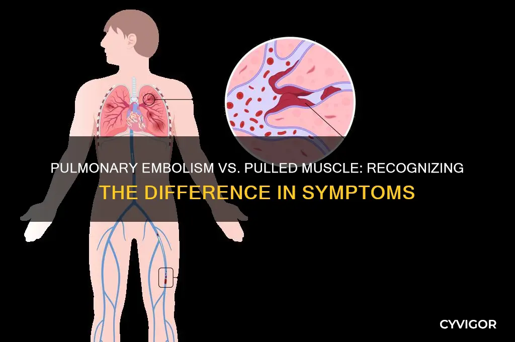does a pulmonary embolism feel like a pulled muscle