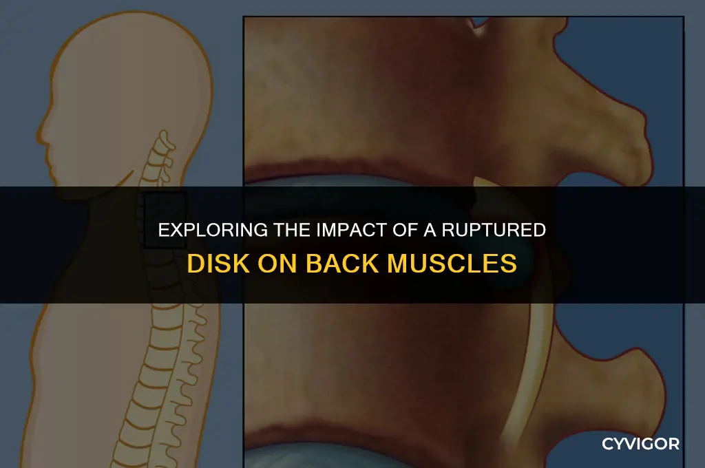 does a ruptured disk affect the muscles in your back