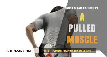 Slipped Disc vs. Pulled Muscle: Understanding the Pain and Symptoms
