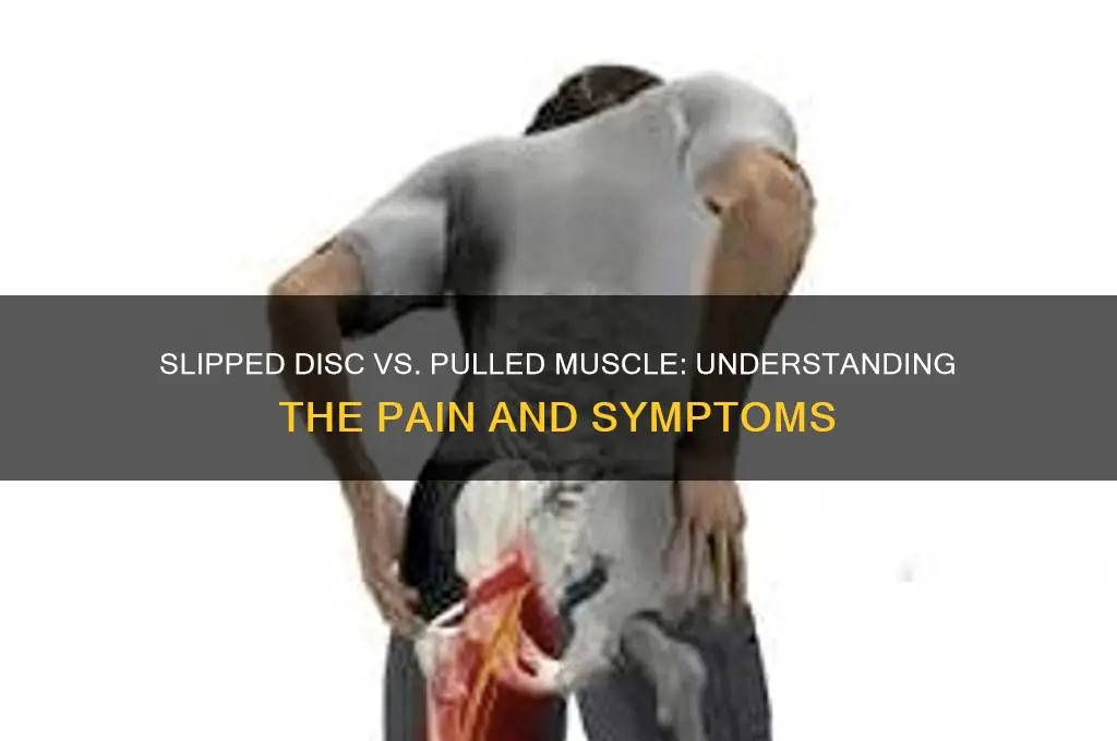 does a slipped disc feel like a pulled muscle
