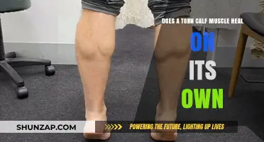 Torn Calf Muscle: Will It Heal Without Medical Intervention?