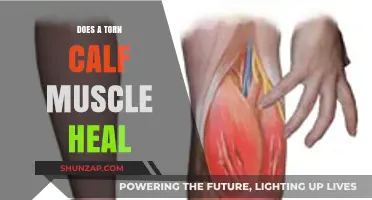 Recovering from a Torn Calf Muscle: A Comprehensive Guide