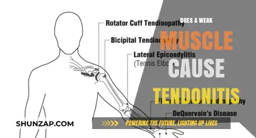 Weak Muscles and Tendonitis: What's the Connection?