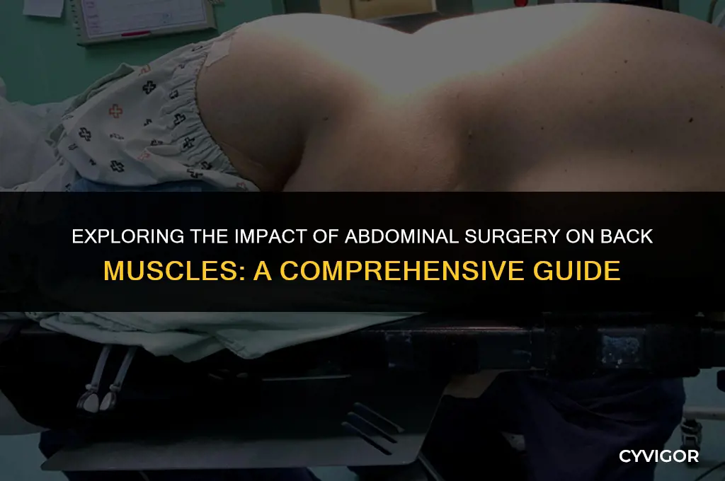 does abdominal surgery affect your back muscles