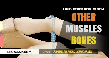 Exploring the Impact of AC Shoulder Separation on Surrounding Muscles and Bones